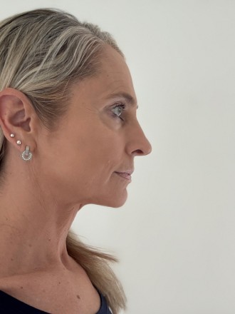 Model Bettina 78080