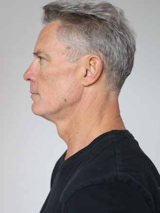 Model Dirk 78868
