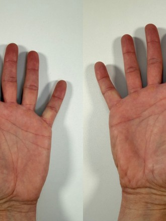 Model Christoph 79950