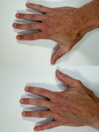 Model Christoph 79950